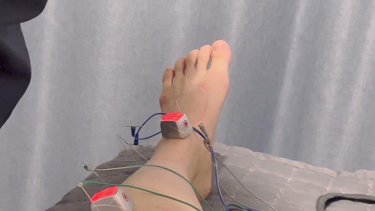 침 · 뜸 치료